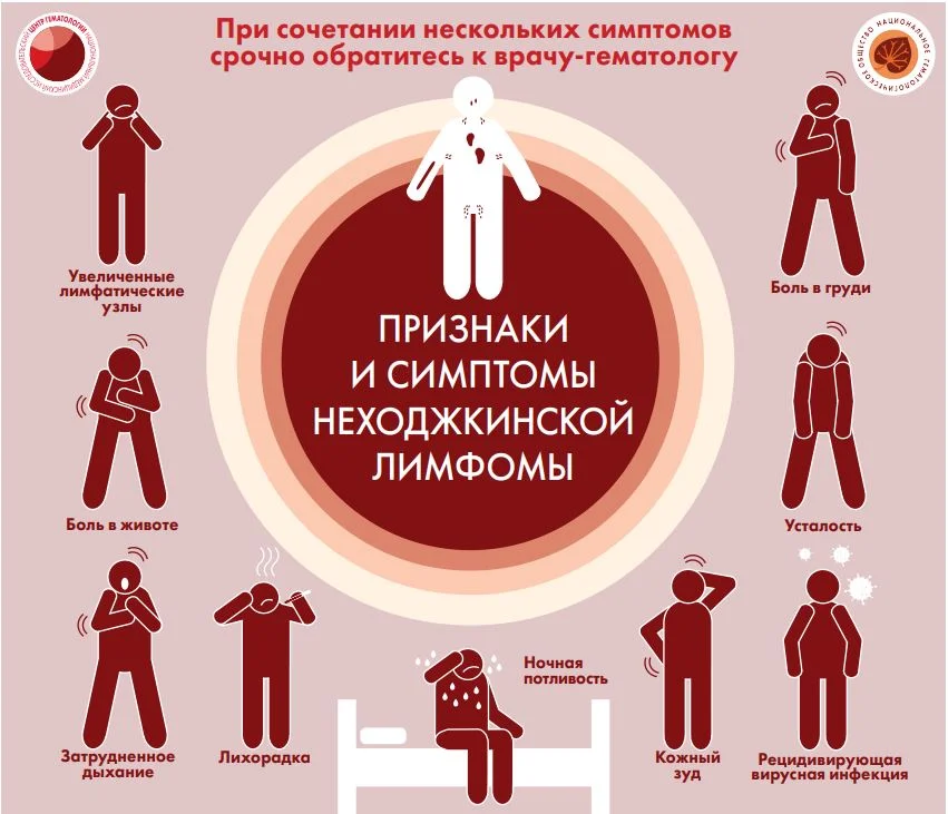 Неходжкинская лимфома